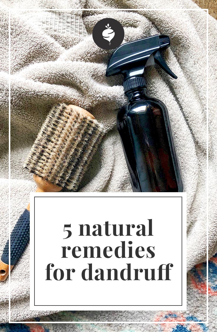 5 Natural Remedies for Dandruff | simplerootswellness.com #podcast #dandruff #naturalremedies #health #hairtip